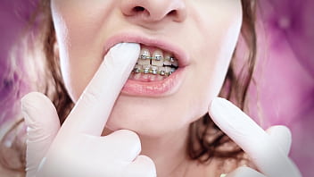 Preview 2 of Bad Milf And Mom - ASMR: upgraded braces with chain-link rubber bands and nitrile gloves (Arya Grander)