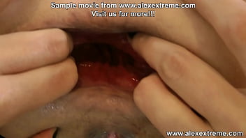 Preview 3 of Dokter Javhihi - Maria Fisting fuck her ass with big dildo &amp_ anal prolapse