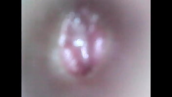 Preview 1 of Xnxx Hindi Desi Com - zaglądam endoskopem do cewki moczowej