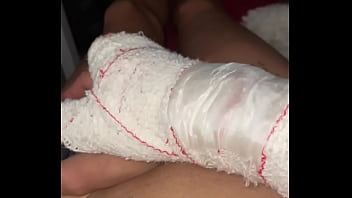 Preview 3 of Amateur Glory Gole - Broken arm