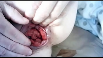 Preview 1 of Bangali Garls Sex - Prolapse Rosebud