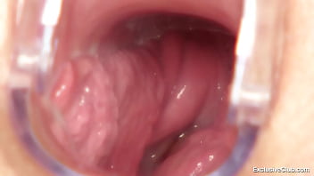 Preview 3 of Famle Sxxs Com - Bella Morgan gynecological examination