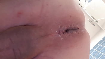 Preview 1 of Brazzers Nurse Anal - Four Balls up in my Ass