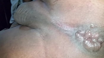 Preview 4 of Tranny Trecker - Ass lips