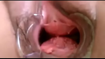 Preview 4 of Znzz Video - Mary cadelona casada com alargador de ginecologista na buceta ( esp&eacute_culo ) se arreganhando todinha pra voc&ecirc_s verem o fundo da xereca arrombada dela,  abrindo bem as pernas,  spread legs