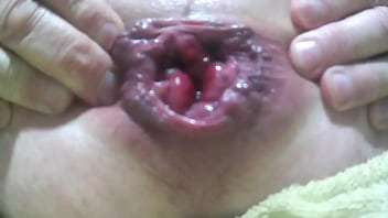 Preview 1 of Tomuch Small Garl - prolapse audio