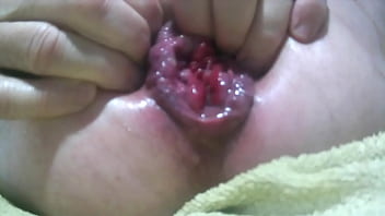 Preview 4 of Tomuch Small Garl - prolapse audio