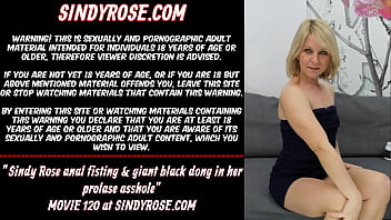 Preview 1 of Soroty Grup - Sindy Rose anal fisting &amp_ giant black dong in her prolapse asshole