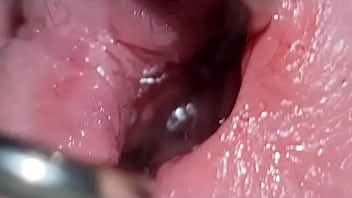 Preview 2 of Sealpack Bf Xxx - penis spreading
