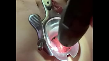 Preview 4 of Gf Bf Romans Sex - Vaginal speculum in the ass
