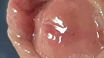 Preview 2 of Www Rep Sex Video Nepali - Precum collecting in my foreskin for you to see close up