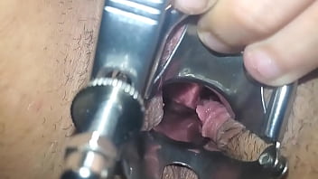 Preview 3 of Phim Zet Viet Trinh - Speculum in pussy close up