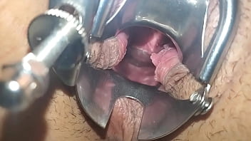 Preview 4 of Phim Zet Viet Trinh - Speculum in pussy close up