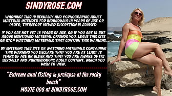 Preview 1 of Brazzers Jordi Xxxxx Sxsari - Extreme anal fisting &amp_ prolapse at the rocky beach Sindy Rose