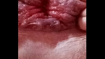 Preview 2 of Mariana Yabeta Avalos - Joe&#039_s prolapse anus