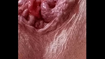 Preview 3 of Mariana Yabeta Avalos - Joe&#039_s prolapse anus