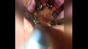 Preview 4 of Dragonball Heantai - Anal speculum