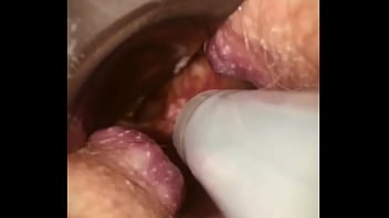 Preview 3 of Sssssxx - Rectal wall injection