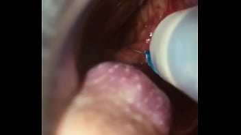 Preview 4 of Sssssxx - Rectal wall injection