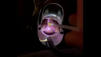 Preview 2 of Mre Cocu - Fucking cervix w painful brush