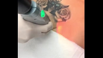 Preview 2 of Sunx Xxx - Depilaci&oacute_n laser en la zona intima a milf tatuada mega nalgona.
