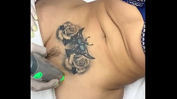 Preview 4 of Sunx Xxx - Depilaci&oacute_n laser en la zona intima a milf tatuada mega nalgona.