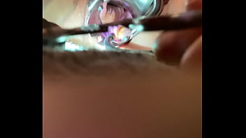 Preview 4 of Hagi Azura - Internal view of Orgasm w sound tenaculum and vibrator