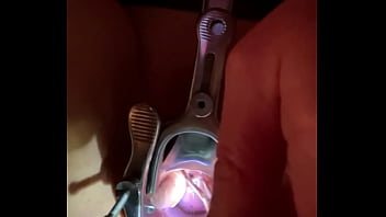 Preview 2 of M Hx Fyw - Insertion of sound tenaculum into cervix