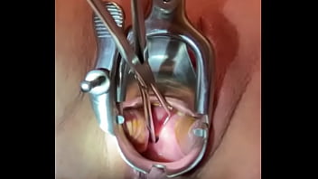 Preview 2 of Brother Fouck Me - Sound tenaculum applying traction to cervix