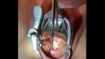 Preview 1 of Brother Fouck Me - Sound tenaculum applying traction to cervix