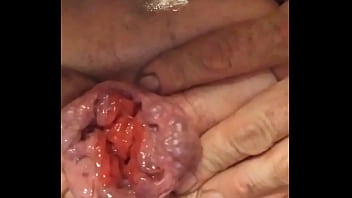 Preview 4 of Deepest Throat Ever Bbc - Solo anal prolapse n
