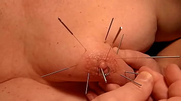 Preview 4 of Like Cone Boobs - Bad acupuncture