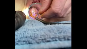 Preview 3 of Alex Grey Porno - Advancing 6mm sound in cervix w cramping