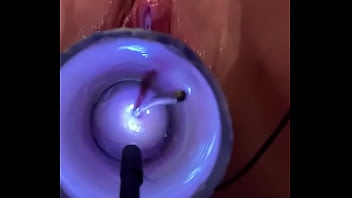 Preview 4 of Sair Bade - Inserting sound into cervix
