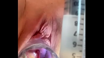 Preview 2 of Inside Moom - as cervix painfully dilated w catheter