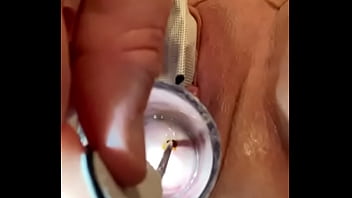 Preview 2 of Reap Giral - Muscle spasms cervix electrosound