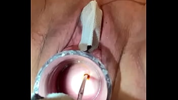 Preview 3 of Reap Giral - Muscle spasms cervix electrosound