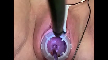 Preview 2 of Shrda Kproo - Painful electrosounding cervix