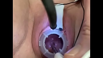 Preview 1 of Shrda Kproo - Painful electrosounding cervix