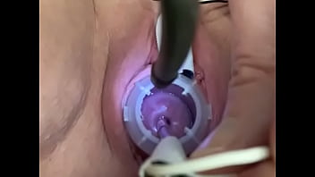 Preview 4 of Shrda Kproo - Painful electrosounding cervix