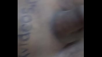 Preview 4 of Moms Fracture Leg - Verification video