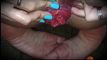 Preview 4 of Cums In Open Eye - Prolapse finger