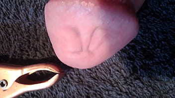 Preview 2 of Sub Babys - marks after accu clamps