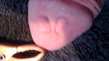 Preview 1 of Sub Babys - marks after accu clamps