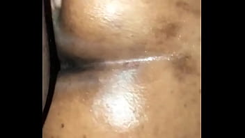 Preview 1 of Myanmar Doctormala - Big Ass Bbw Ebony