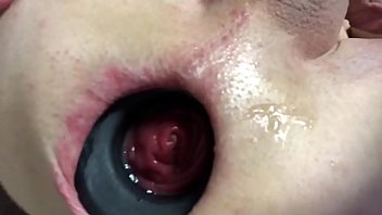 Preview 4 of Balckedraw Com - TRYING OUT MY NEW ANAL EXPANSION RING PART 1