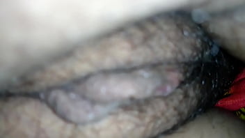 Preview 4 of Gynae Exam - My hairy pussy