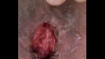 Preview 4 of Xxx Los Simpson - Vietnam Anal prolapse after fisting
