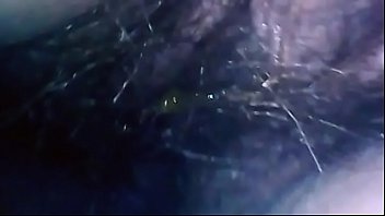 Preview 2 of Alllondon Keyes - Exciting endoscope exploration of mom&#039_s hairy pussy and her asshole