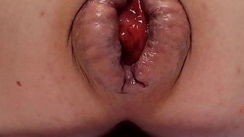 Preview 1 of Hot Brazzers Xnx - Contender For Biggest Prolapse (Male Warning!)